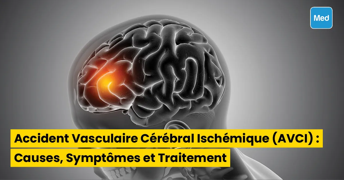 Accident Vasculaire Cérébral Ischémique (AVCI) : Causes, Symptômes et Traitement